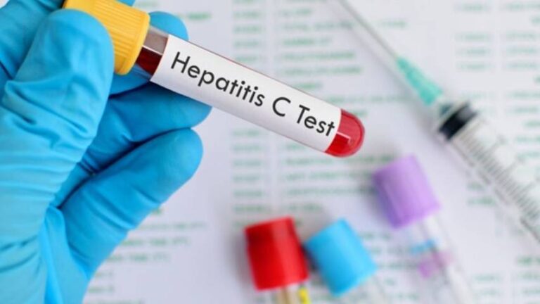 OMS alerta que la nueva hepatitis es un tema «muy urgente»