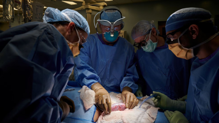 Logran que riñón de cerdo modificado funcione un mes en un cuerpo humano
