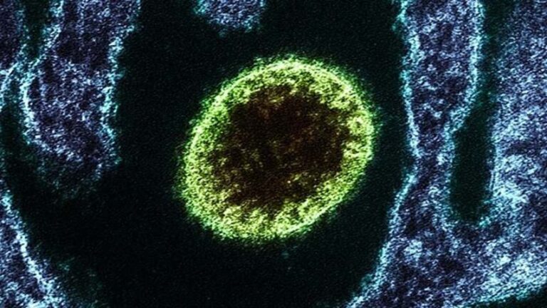 Nipah: enfermedad vírica que puede convertirse en pandemia