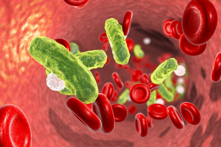 Vida: ¿Qué es la sepsis y cómo controlarla?