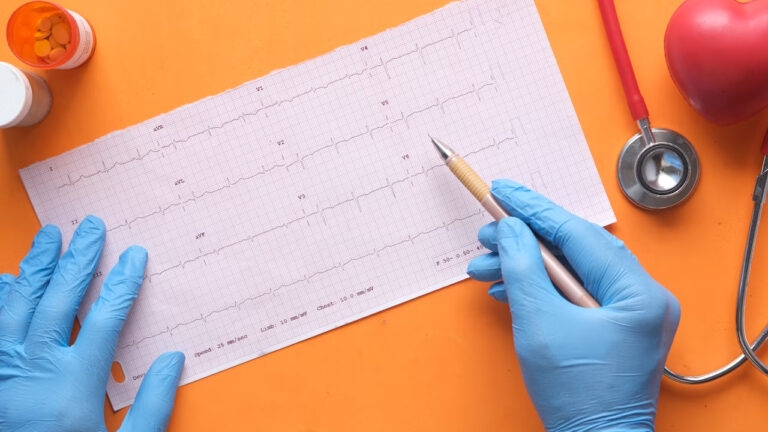 Especialista advierte que enfermedades del corazón pueden causar «muerte súbita»