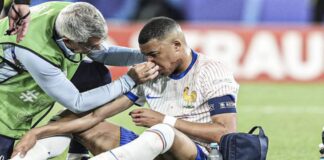Mbappé no requiere cirugía