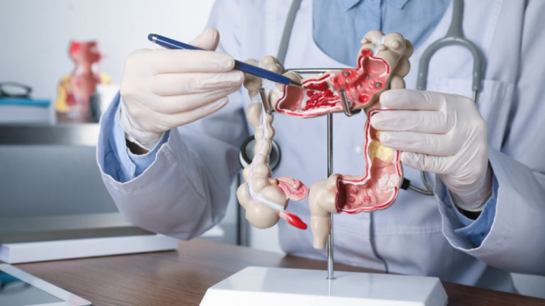 Realizarán jornada de pesquisa de cáncer colorectal en el Hospital Domingo Luciani
