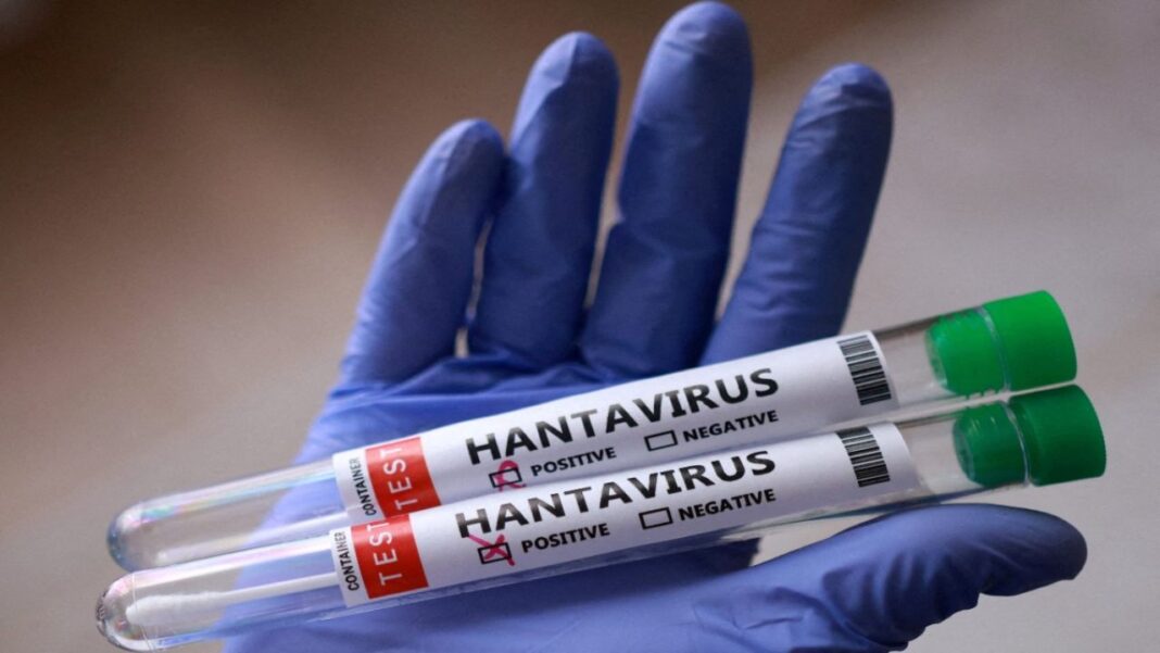 Autoridades confirmaron 3 fallecidos por Hantavirus en Anzoátegui