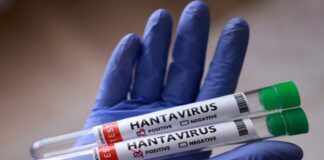 Autoridades confirmaron 3 fallecidos por Hantavirus en Anzoátegui